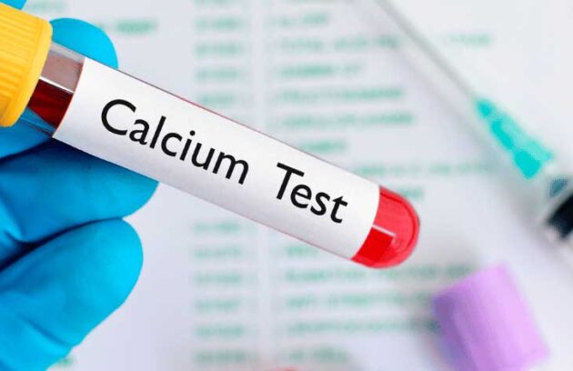 spx-clinica-spx-imagem-exame-de-calcio-no-sangue