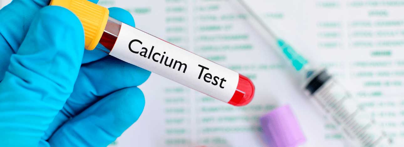 spx-clinica-spx-imagem-exame-de-calcio-no-sangue