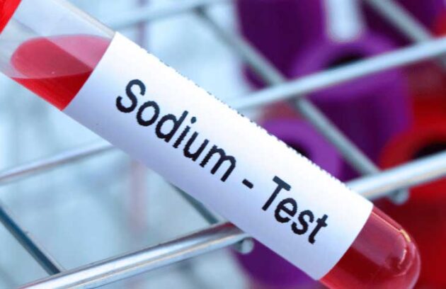 spx-clinica-spx-imagem-exame-de-sodio