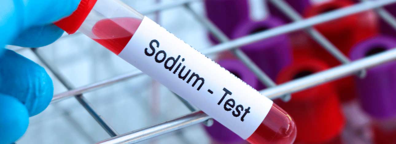 spx-clinica-spx-imagem-exame-de-sodio