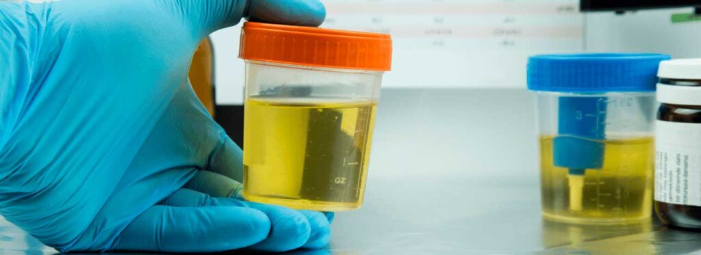 spx-clinica-spx-imagem-importancia-do-exame-de-urina-tipo-1