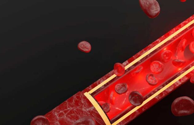 spx-clinica-spx-imagem-niveis-de-ferro-no-organismo