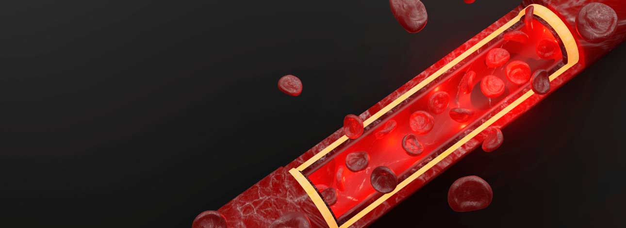 spx-clinica-spx-imagem-niveis-de-ferro-no-organismo