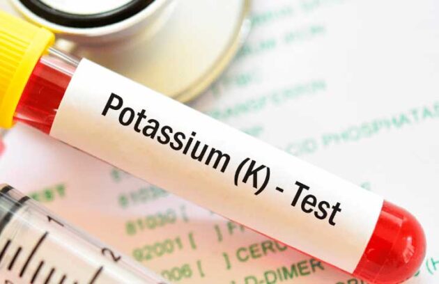 spx-clinica-spx-imagem-o-que-e-o-exame-de-potassio