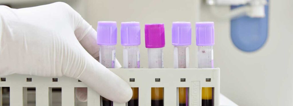 spx-clinica-spx-imagem-o-que-e-o-hemograma-completo