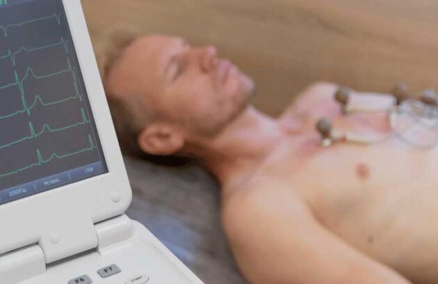 spx-clinica-spx-imagem-para-que-serve-eletrocardiograma