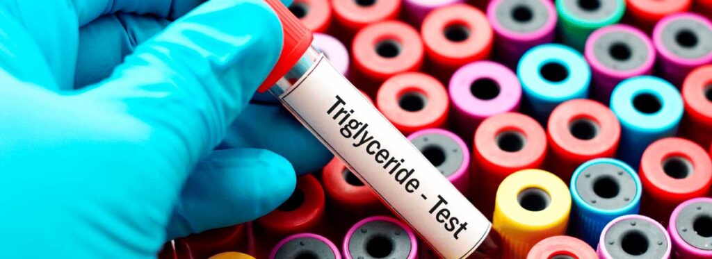 spx-clinica-spx-imagem-perigos-do-triglicerideos-elevados
