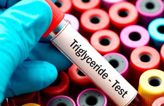 spx-clinica-spx-imagem-perigos-do-triglicerideos-elevados