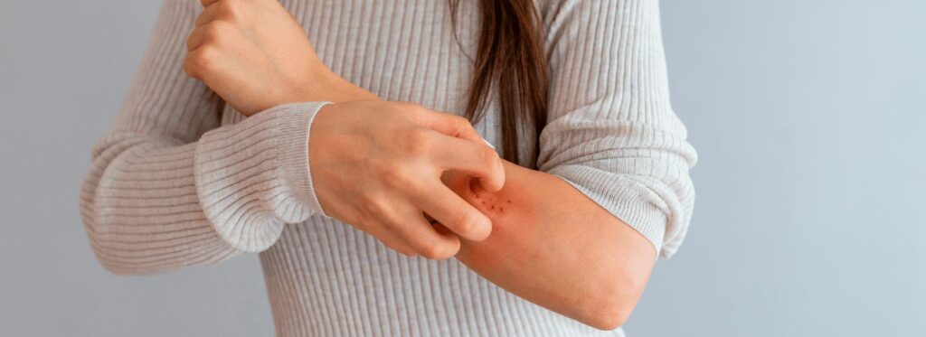 spx-clinica-spx-imagem-como-identificar-a-alergia