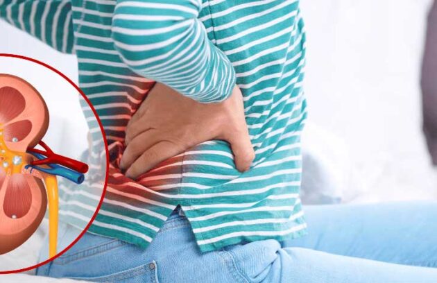 spx-clinica-spx-imagem-evitar-pedra-nos-rins