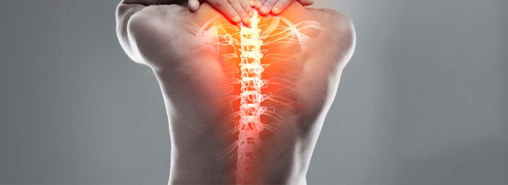 spx imagem spx clinica blog Dor nas Costas o que pode Ser ortopedia ortopedista coluna vertebras