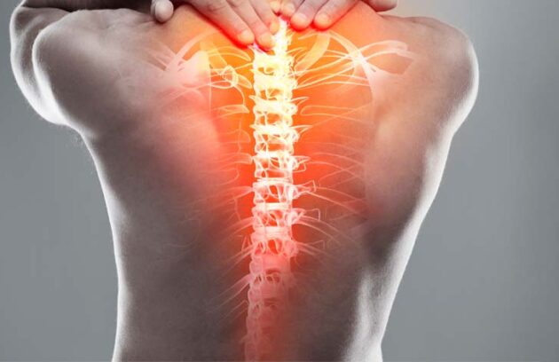 spx imagem spx clinica blog Dor nas Costas o que pode Ser ortopedia ortopedista coluna vertebras