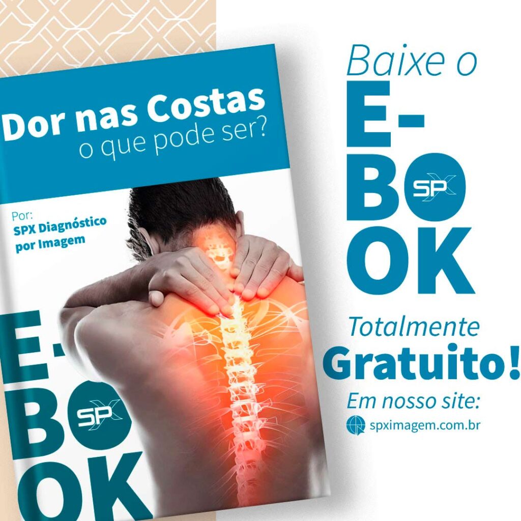 E-book sobre dor nas costas, da SPX Diagnóstico por Imagem