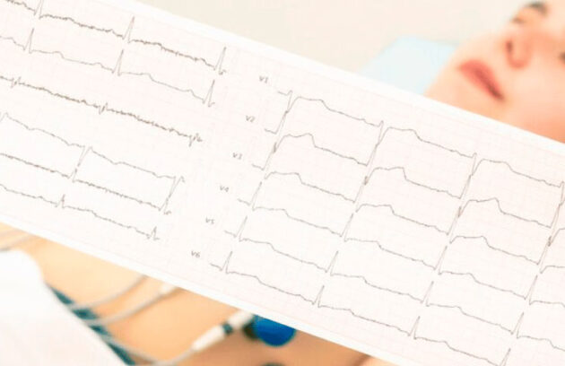spx-clinica-spx-imagem-eletrocardiograma-o-que-e-riscos