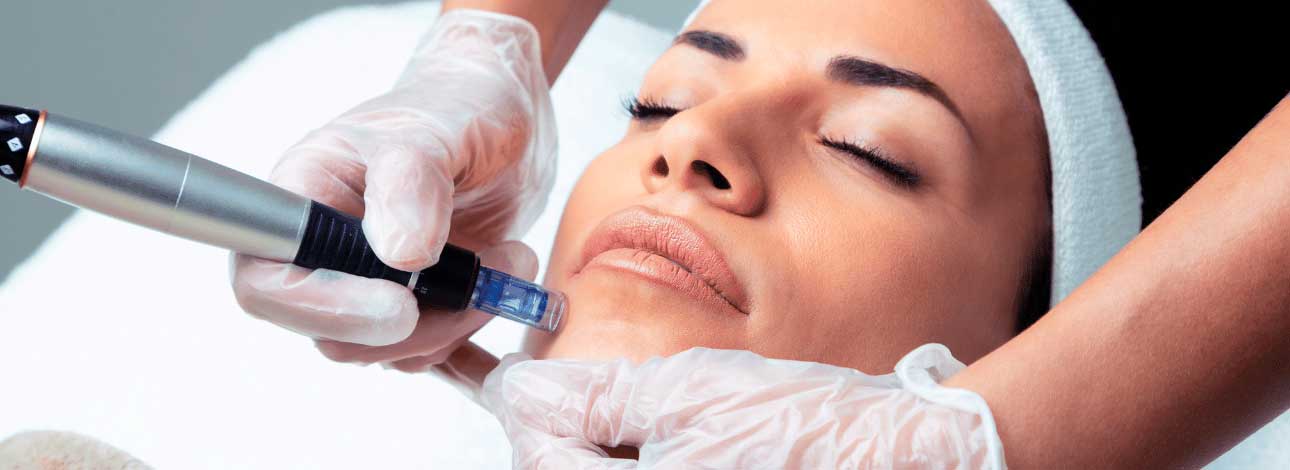 spx-clinica-spx-imagem-microagulhamento-facial
