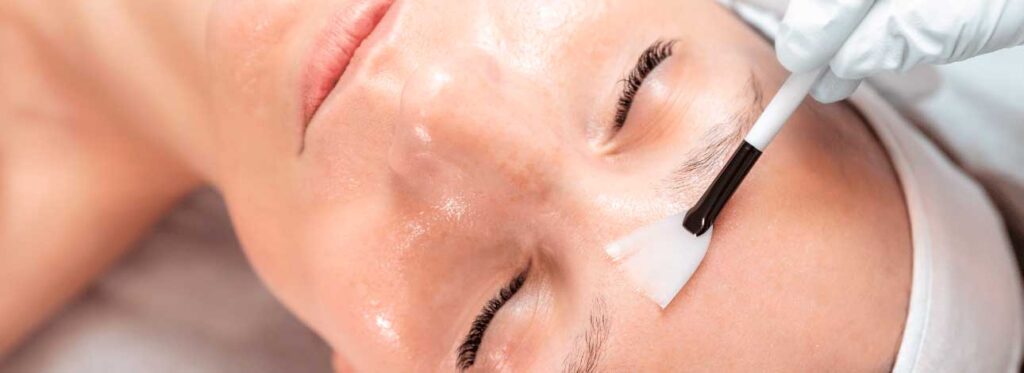 spx-clinica-spx-imagem-peeling