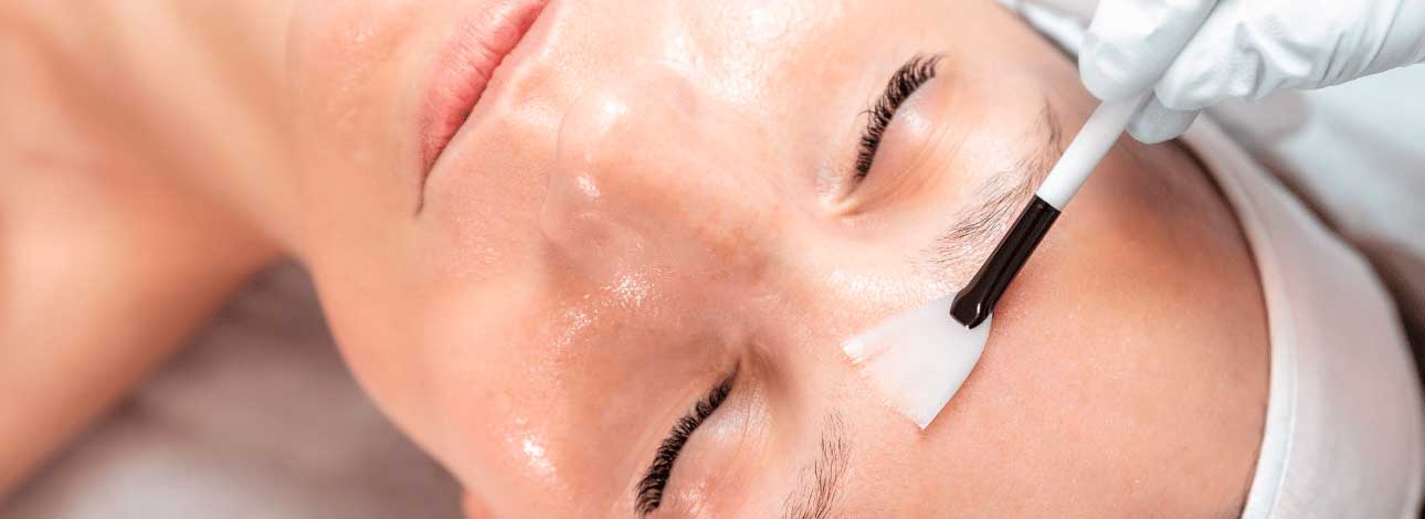 spx-clinica-spx-imagem-peeling