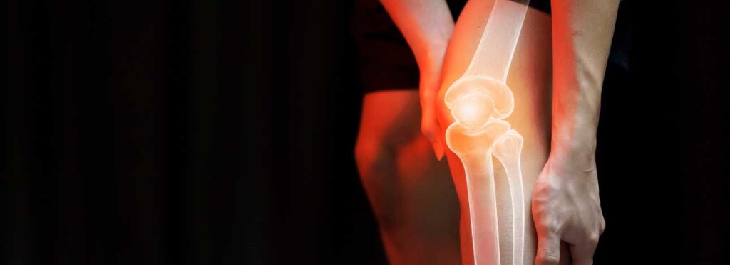 spx-clinica-spx-imagem-prevenir-dores-nos-joelhos