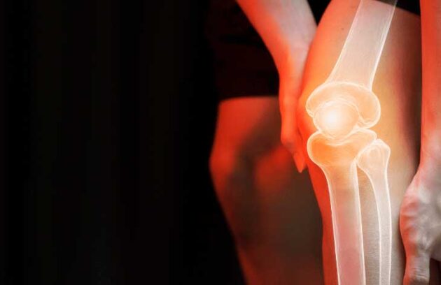 spx-clinica-spx-imagem-prevenir-dores-nos-joelhos