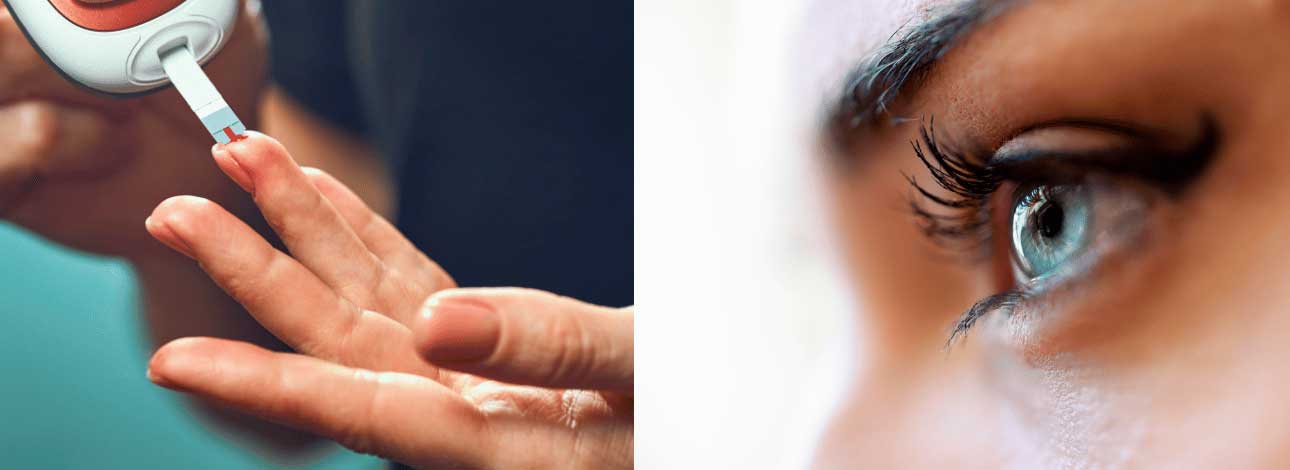 spx-clinica-spx-imagem-diabetes-pode-afetar-a-visao
