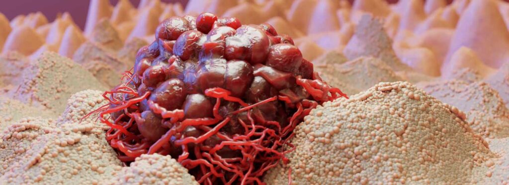 spx-clinica-spx-imagem-tratamento-do-cancer-devem-ter-com-o-coronavirus