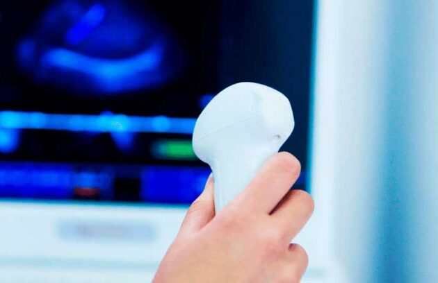 spx-clinica-spx-imagem-beneficios-de-alugar-ultrassom