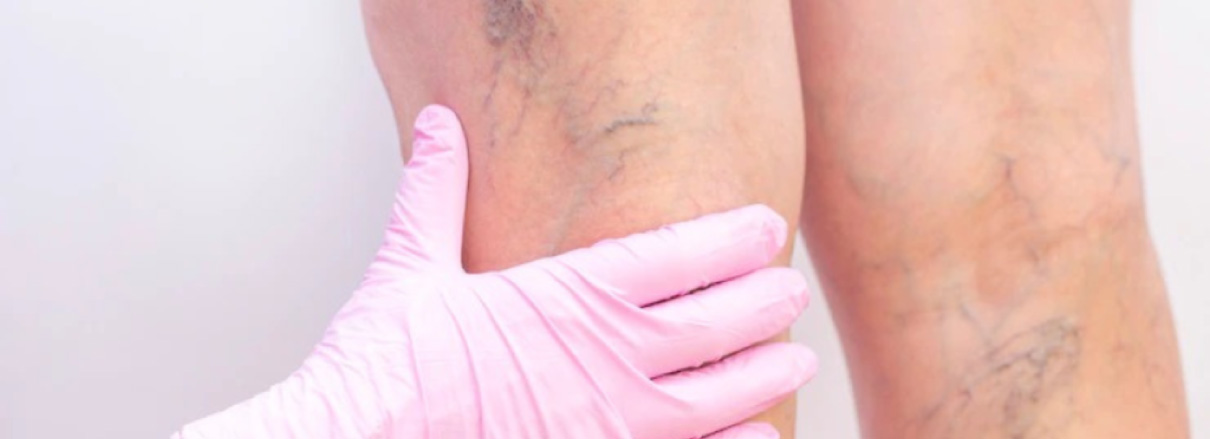 spx clinica spx imagem principais duvidas sobre o medico vascular