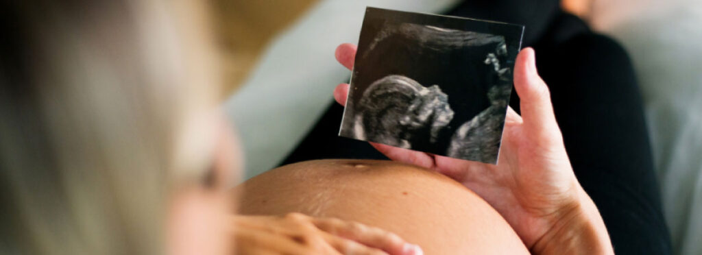 Spx-clinica-spx-imagem-os-cuidados-durante-a-gravidez-