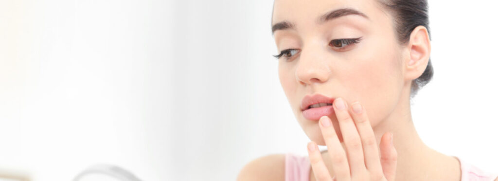 spx-imagem-spx-clinica-herpes-labial-dermato-dermatologia-dermatologista