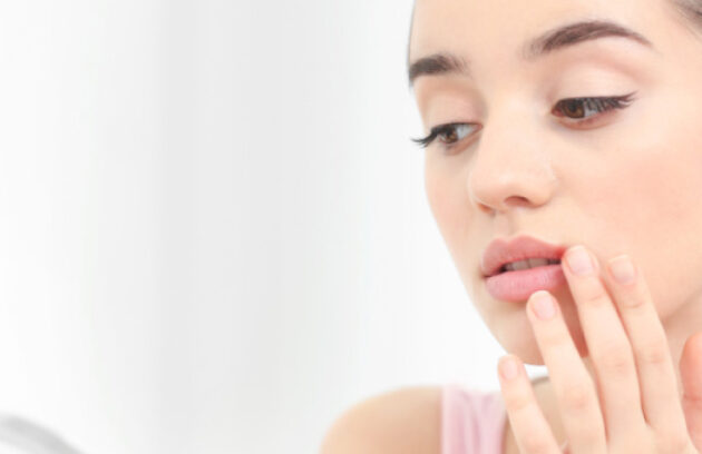 spx-imagem-spx-clinica-herpes-labial-dermato-dermatologia-dermatologista