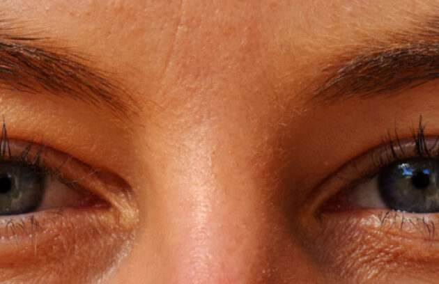 Spx-clinica-spx-imagem-Como-evitar-a-sindrome-dos-Olhos-Secos