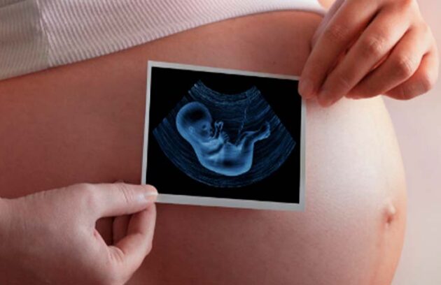 spx clinica spx imagem Exames Pre-Natal: quais fazer gravida gravidez saude exames consultas