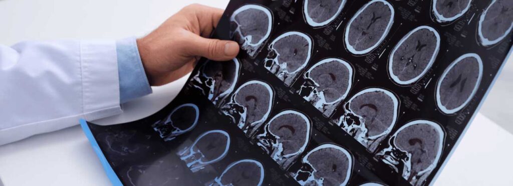 Médico analisando resultado de exame de paciente com esclerose múltipla