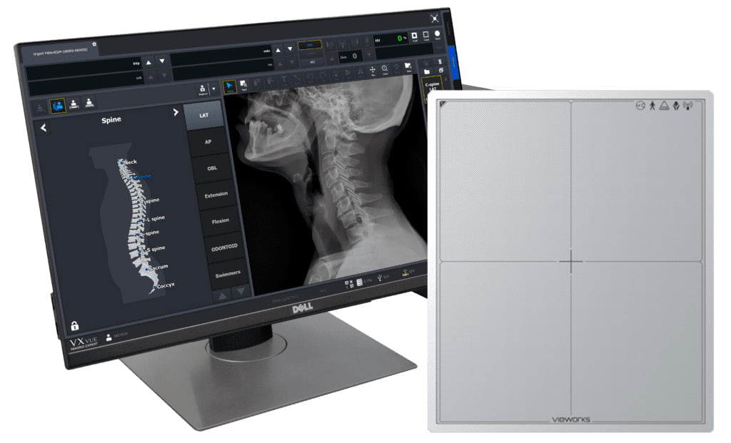 locacao de equipamentos medicos DR radiologia digital