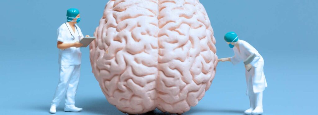 spx imagem spx clinica vitamina c pode ajudar no Alzheimer