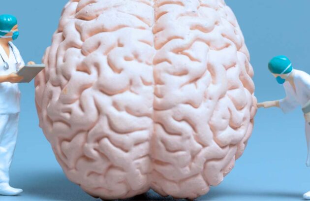 spx imagem spx clinica vitamina c pode ajudar no Alzheimer