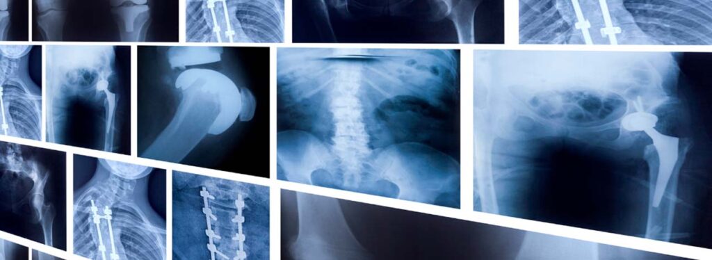 spx imagem spx clinica exames de imagem