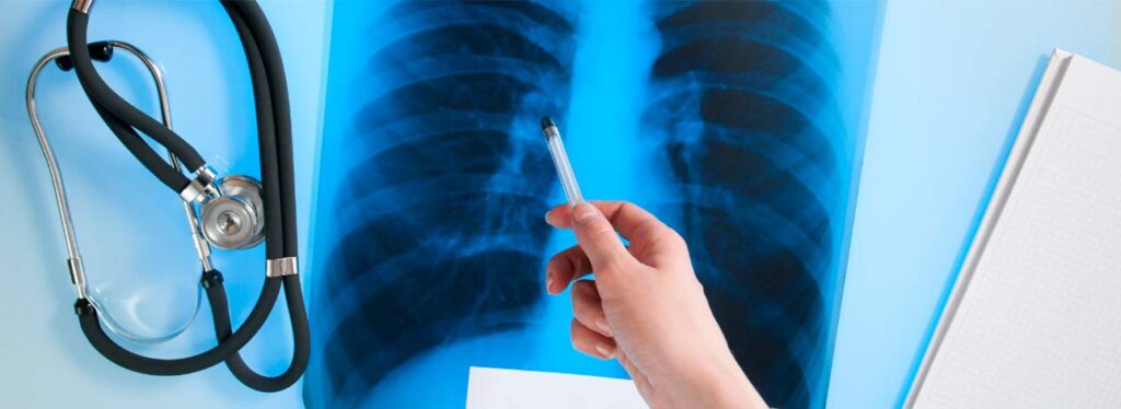 spx-clinica-spximagem-radiologia-o-que-e1