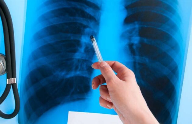 spx-clinica-spximagem-radiologia-o-que-e1