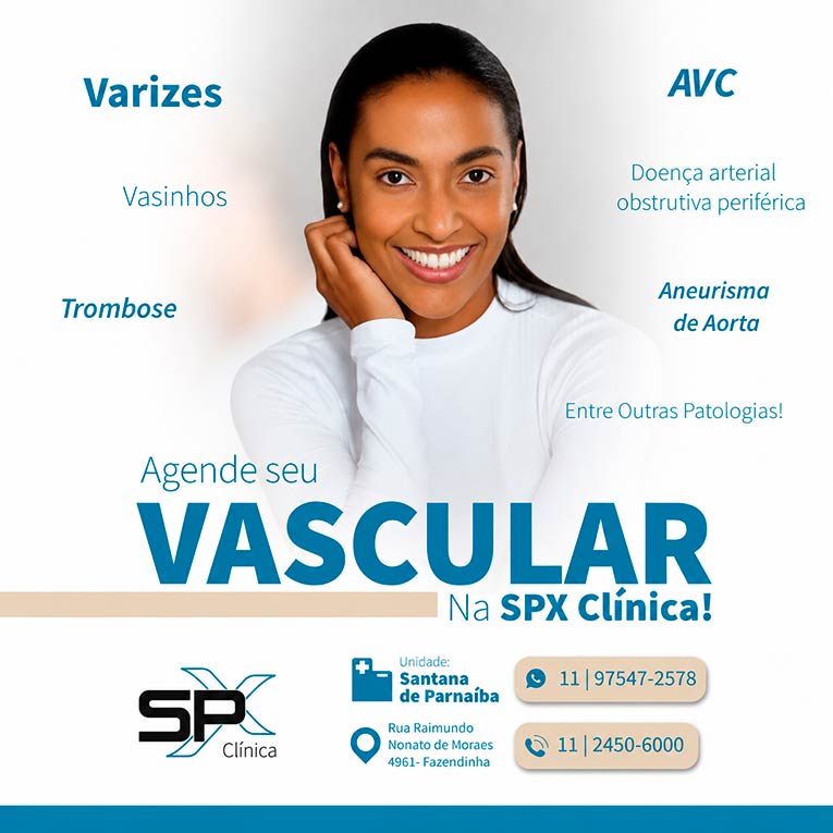 Dra. Beatriz Sant'Anna, vascular na SPX Santana de Parnaíba