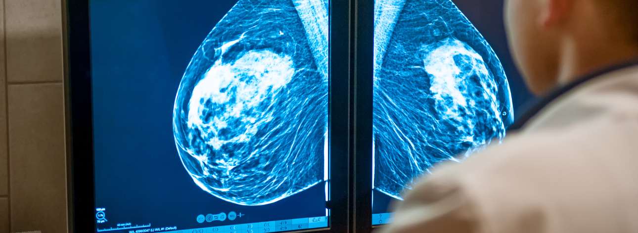 spx-clinica-spx-imagem-inteligencia-artificial-cancer-de-mama (1)