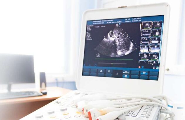 spx-clinica-spx-imagem-ultrassom-locacao-beneficios (2)