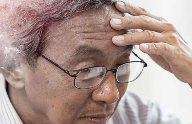 spx-imagem-spx-clinica-diagnostico-por-imagem-medicamento-alzheimer (2)