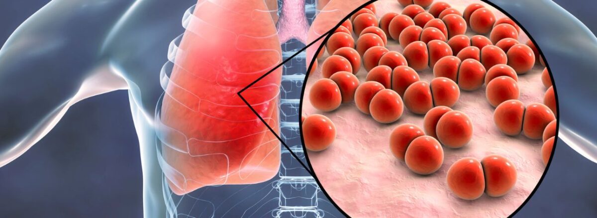 spx-clinica-spx-imagem-Vacina Bronquiolite Pneumonia (2)