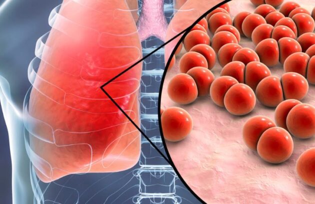 spx-clinica-spx-imagem-Vacina Bronquiolite Pneumonia (2)