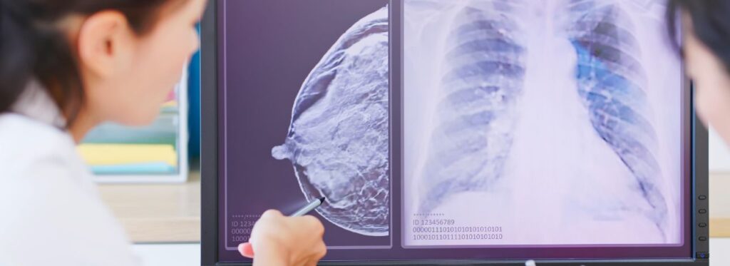 spx-clinica-spx-imagem-diagnostico-por-imagem-medicamento-reduz-câncer-de-mama (1)