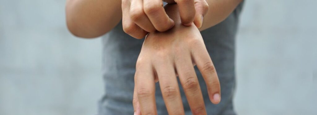 spx-clinica-spx-imagem-esporotricose-aumento-doença (2)