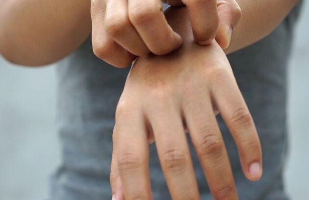 spx-clinica-spx-imagem-esporotricose-aumento-doença (2)