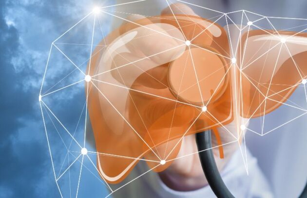 spx-clinica-spx-imagem-inteligência-artificial-diagnóstico-cancer-figado (2)