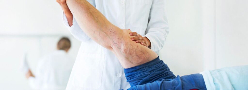 spx-clinica-spx-imagem-prevenir-varizes-doenças-circulatórias (2)